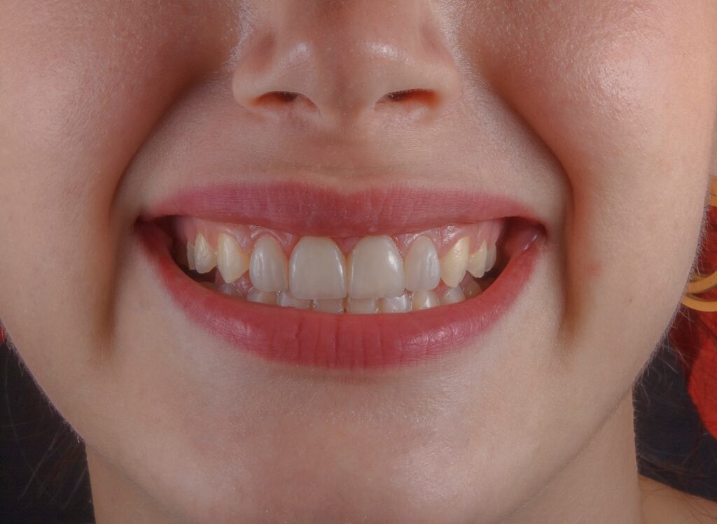 a close up of a person's mouth